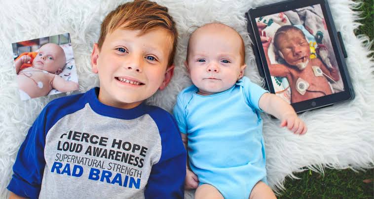 Paediatric and Adult Hydrocephalus